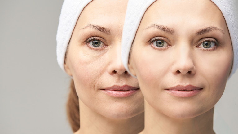 Как да се справим с подпухването на лицето