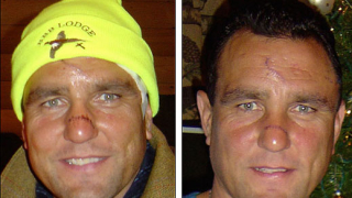 Вини Джоунс: Имам 48 шева по лицето