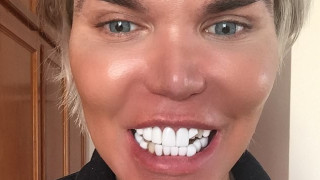 Мъжката кукла Барби Кен остана без няколко зъба 34 годишният