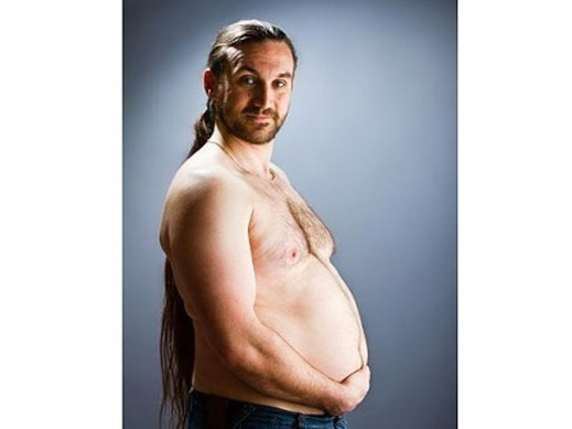 Бременен мъж шашна лекарите