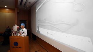 Паразитни червеи са открити в тежко ранения севернокорейски войник избягал