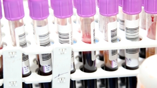 48 часа след катастрофата на столичния бул Черни връх при