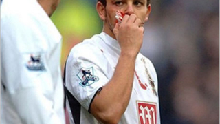 Съотборник на Бербатов с 4 избити зъба в мача с Портсмут