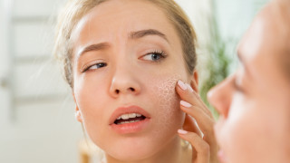 Как да се справим със сухата кожа през зимата
