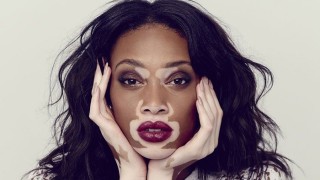 Уини Харолу е световно известна с това че не е