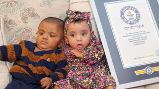 Близнаците, които още с раждането си поставиха рекорд на Гинес