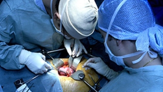 Лекари спасиха канадка, премахвайки белите й дробове за 6 дни