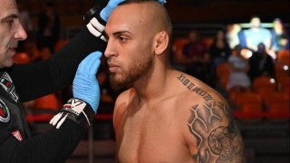 Митко Илиев бе опериран успешно от екип на МБАЛ Бургас