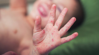 Ръстът на движение срещу ваксините в Европа подхранвано в