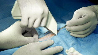 Ежегодно над 2 200 000 пациенти лежат в болница На