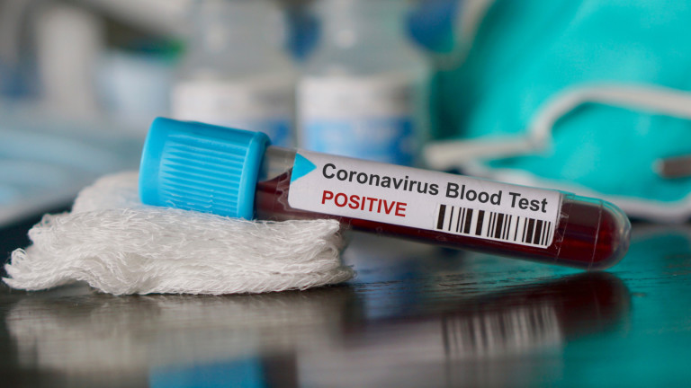 Изследвания: Коронавирусът отнема по 10 г. живот на жертвите си    