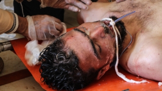 Взрив избухна в сирийски бежански лагер има десетки загинали и