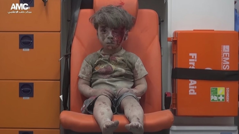 Снимките на малкия Омран от Алепо са фалшиви, заяви сирийският президент 