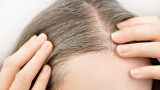 Побеляването на косата и как ни влияе стресът