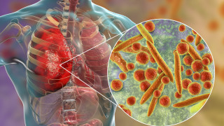 Подобно на Китай европейски страни наблюдават нарастващи случаи на Mycoplasma