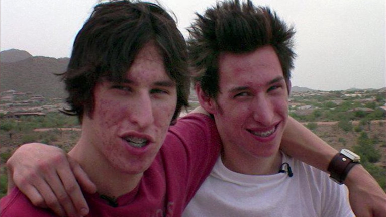 Така са изглеждали братята Шлеп преди интервенциите.