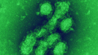 Канадски учени дешифрираха генома на свинския грип