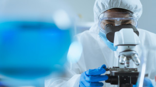 Общият брой на лабораторно потвърдените случаи на маймунска едра шарка