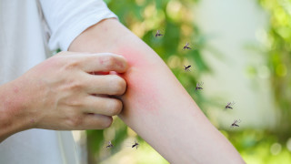 Как да надхитрим комарите с... цвета на дрехите си