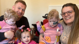 По рано този месец излезе новината за най недоносените близнаци в света